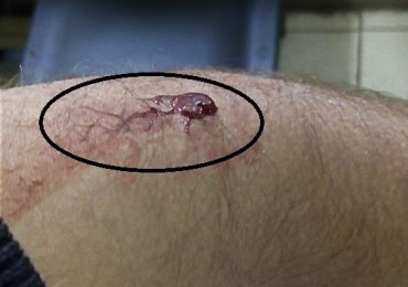 Padre de familia es herido con arma blanca y un palo con clavo al ser asaltado en Pudahuel