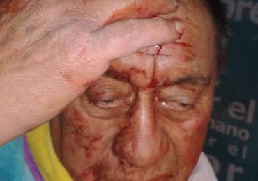 Chofer de TranSantiago es agredido con palo en Cerro Navia