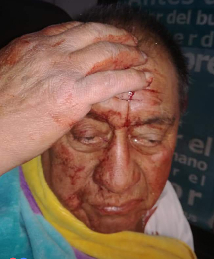 Chofer de TranSantiago es agredido con palo en Cerro Navia