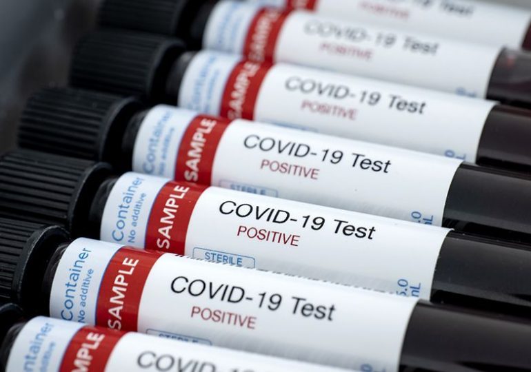 COVID-19: 236 casos activos en Pudahuel, 161 en Cerro Navia y un total de 41.428 en el país