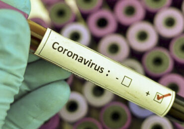 67% de las muestras de personas con sospecha de coronavirus en sector poniente deberán repetirse