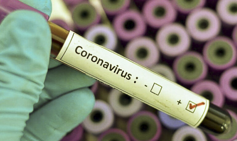 67% de las muestras de personas con sospecha de coronavirus en sector poniente deberán repetirse