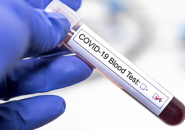 Coronavirus: En Pudahuel hay 180 casos activos mientras que Cerro Navia tiene 132