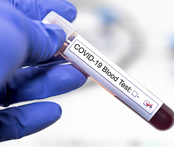 Coronavirus: En Pudahuel hay 180 casos activos mientras que Cerro Navia tiene 132