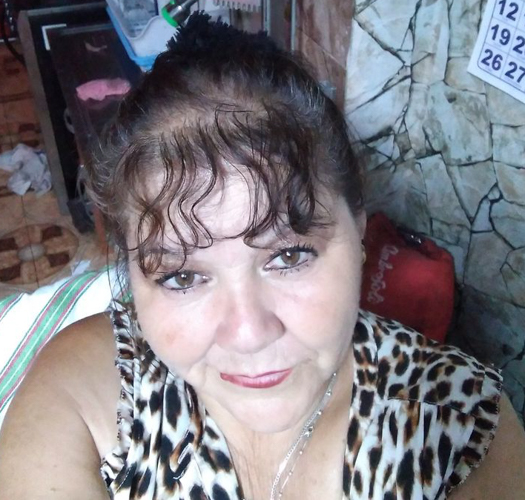 Dirigenta Social de Pudahuel sufre accidente domiciliario y queda hospitalizada