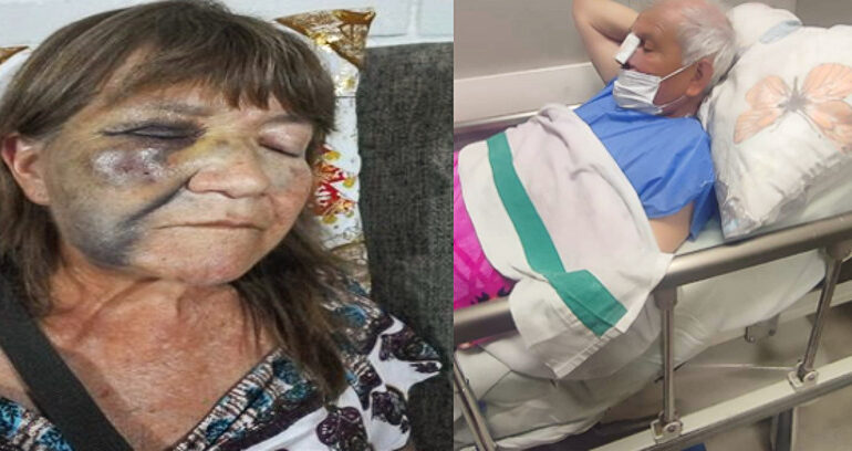 Dos adultos mayores quedan con diversas lesiones por caída en veredas desnivelada en Pudahuel