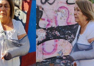 Dirigente social Elsa Bravo sufrió grave lesión por caída en vereda desnivelada en Pudahuel