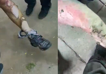 Explosiones y llamas en el INBA: 35 estudiantes heridos de diversa gravedad y uno de ellos es de Pudahuel