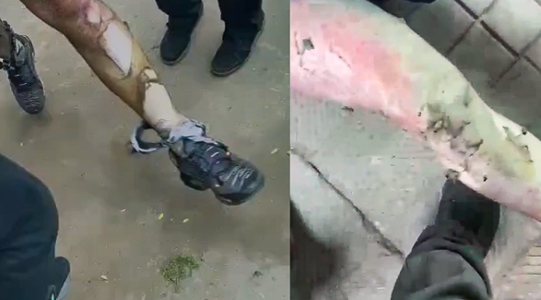 Explosiones y llamas en el INBA: 35 estudiantes heridos de diversa gravedad y uno de ellos es de Pudahuel