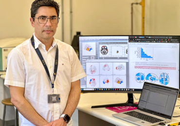 Relojes cerebrales: investigador estudia cómo factores sociales perjudican la edad del cerebro