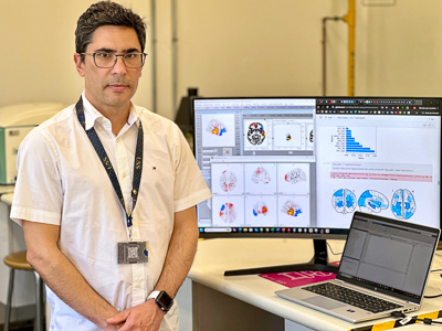 Relojes cerebrales: investigador estudia cómo factores sociales perjudican la edad del cerebro